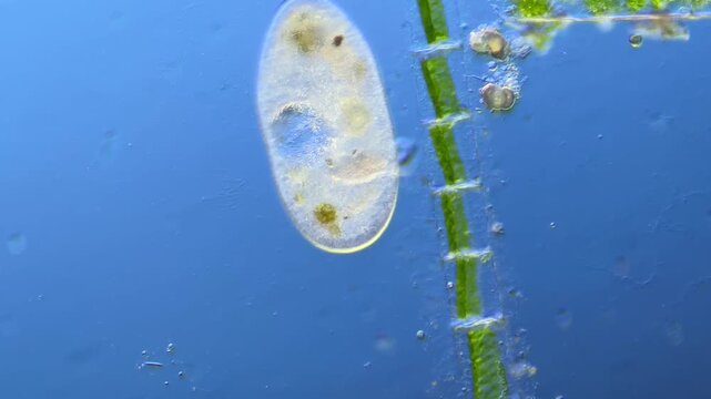 Protists Ciliates  under the microscope at 100x Magnification