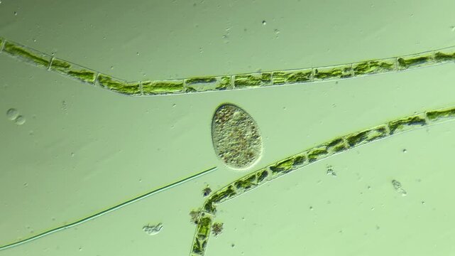 Protists Ciliates  under the microscope at 100x Magnification