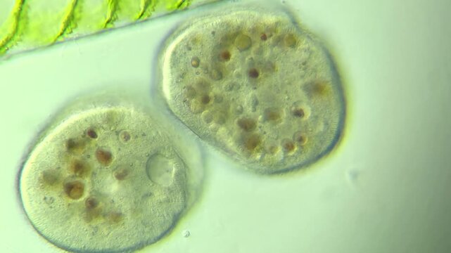 Protists Ciliates  under the microscope at 100x Magnification