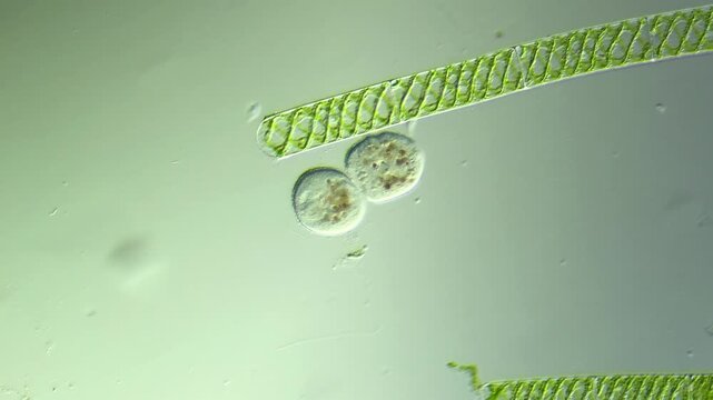 Protists Ciliates  under the microscope at 100x Magnification