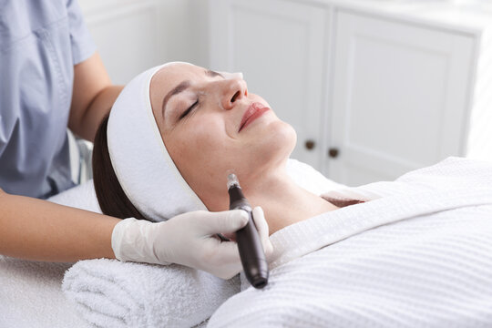 Woman undergoing microneedling procedure in beauty salon, closeup