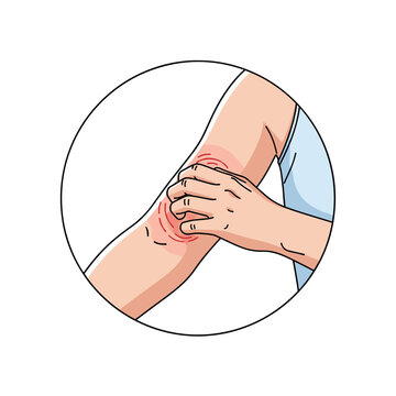 Person scratching arm due to itching in a simple illustration  