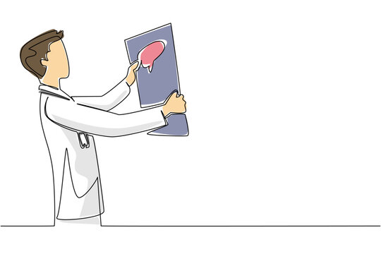 One line drawing of a male doctor examining a brain scan represents the science and health concept, designed to highlight World Brain Tumor Day as an important international medical awareness event.