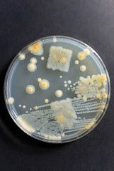 Petri Dish with Bacterial Colonies  in Microbiology Lab