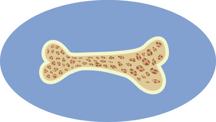 Vector Illustration of a Bone Suffering from Aging and Osteoporosis. Porous brittle bone because of degenerative age related process    
