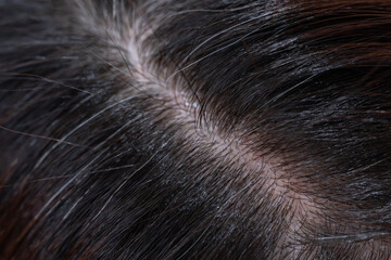 髪　女性　クローズアップ