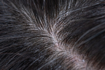 髪　女性　クローズアップ