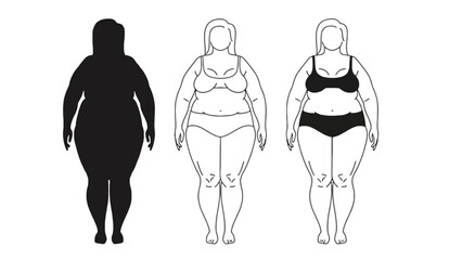 Stages of woman's weight loss journey illustrated
