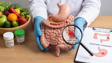 Doctor hands holding magnifying glass over leaky gut intestine model. Probiotic supplements and prebiotic healthy food bowl. Colon gastric cancer chart and stomach digestion medical concept