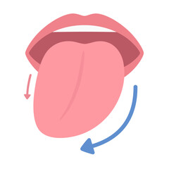 右舌下神経麻痺の挺舌のイラスト