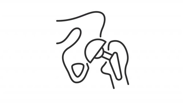 Animated hip joint ball implant line icon. Biocompatible prosthesis animation. Artificial joint. Biological structure replace. Outline element on white background. HD video with alpha channel