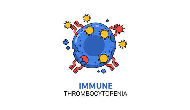 Immune Thrombocytopenia Medical Concept Illustration