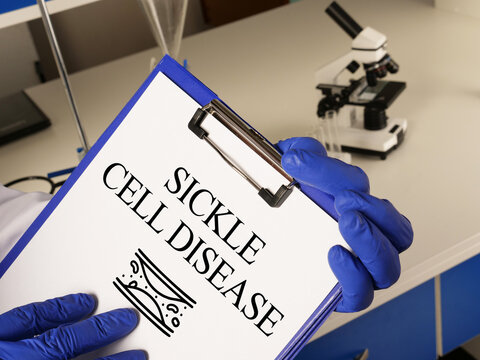 Sickle Cell Disease is an inherited blood disorder caused by a mutation in the HBB gene
