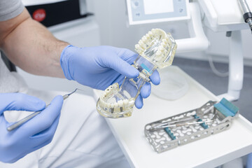 Dentist demonstrating jaw model with implants during dental consultation in clinic