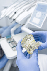 Dental implant model in gloved hands for restorative treatment planning in modern clinic