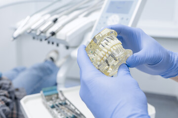 Gloved dentist holding implant jaw model for patient education and treatment planning