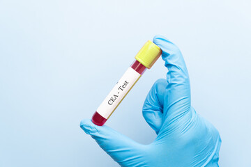 Obraz premium Doctor holding a test blood sample tube with CEA (Carcinoembryonic Antigen) test, tumor marker for colorectal cancer.
