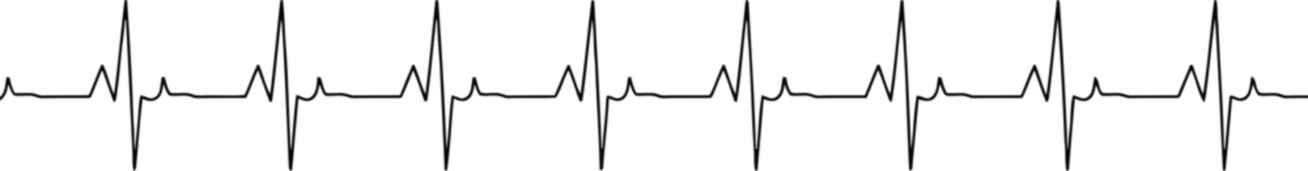 Black continuous line drawing illustrates a normal heartbeat rhythm on a white background monitor