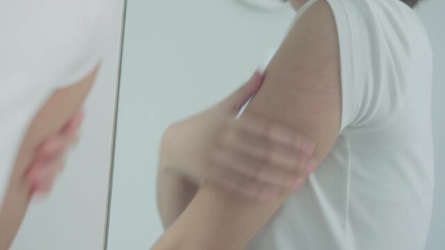 skin problem and beauty. Young woman scratch body has itchy skin from skin allergic, steroid allergy, sensitive skin, red from sunburn, chemical allergy, rash, insect bites, Seborrheic Dermatitis.