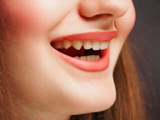 Fototapeta premium Clean and whitened teeth in a excellent shape after successful bracket removal. Result of long and expensive procedure. Health care and beauty concept. Dentist job.