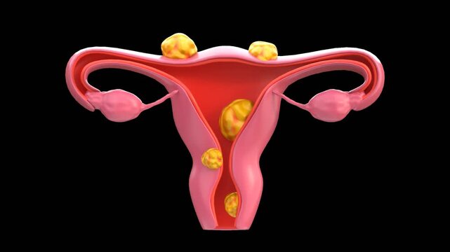 3D Pcos | Alpha Channel