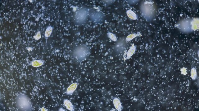 Single-celled paramecium with symbiotic alga inside