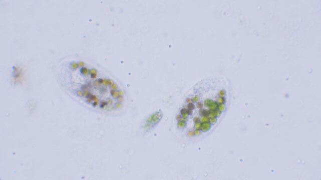 Single-celled paramecium with symbiotic alga inside