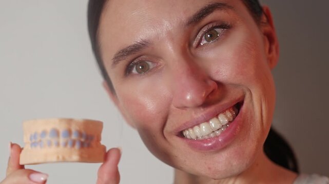 Woman uses dental trays for teeth whitening at home. Girl pours peroxide solution from syringe and applies on teeth, smiling to camera. Neutral background. Female holds trays in a purple case.