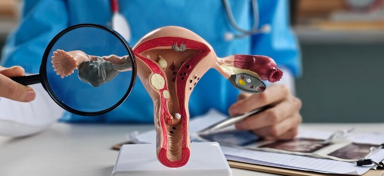 Doctor with Uterus and Ovaries anatomy model and magnifying glass.