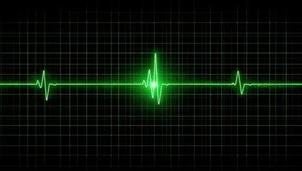 Glowing green electrocardiogram displaying a heartbeat rhythm on a dark background grid