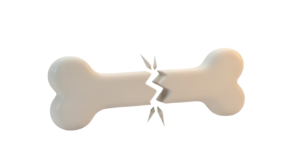 Broken bone PNG isolated on transparent background, fracture symbol for medical and health concepts, injury