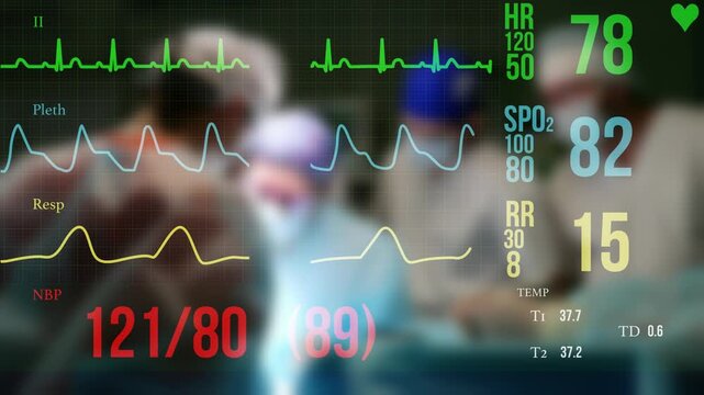 An EKG machine displays patient vital signs with a team of surgeons operating in the blurred background, illustrating a concept of healthcare, surgery, or a medical emergency