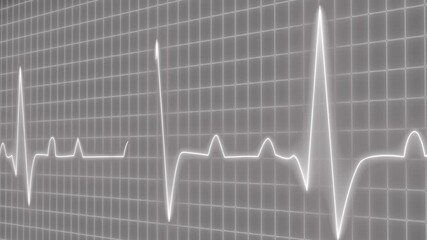 Electrocardiogram heartbeat waveform Line Animation - Powered by Adobe