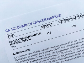 CA 125 test for cancer paper report top view backdrop. Ovarian cancer marker report.