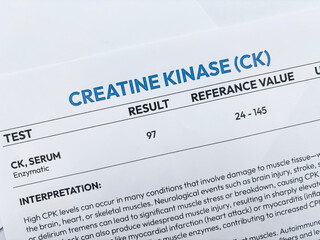 Creatine Kinase test report top view medical concept design backdrop.