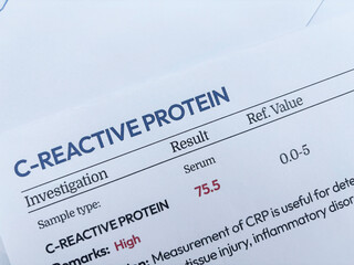 C-Reactive protein test report showing high value on the test top view backdrop.