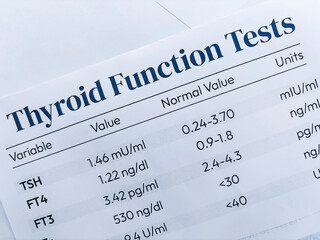 Thyroid function Test report top view medical background.