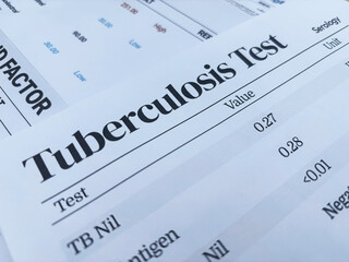 Tuberculosis test report close up showing values and result backdrop.