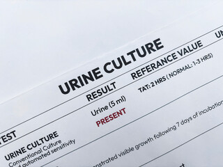 Urine culture test report showing present status in result with reference value, medical backdrop