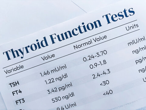 Thyroid function Test report top view medical background.