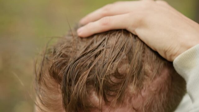 closeup white man checking hairline in overcast park, fingers raking through damp thinning hair, visible scalp and receding temples, worried expression, natural light and autumn foliage