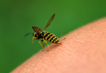 close-up of a striped dangerous insect wasp stings a person in the skin of his hand