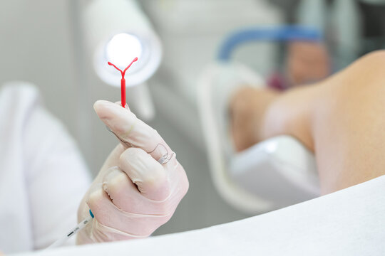 Gynecologist holding an IUD birth control device before using it for patient