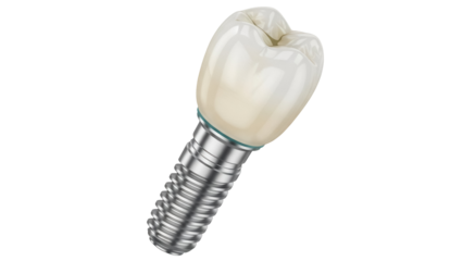 Dental implant PNG isolated on transparent background, artificial tooth for stomatology and prosthetics, screw-type implant