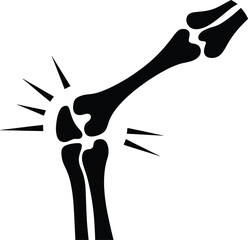 Vector illustration of a human knee joint with radiating pain lines, ideal for medical, orthopedic, or anatomical design use.