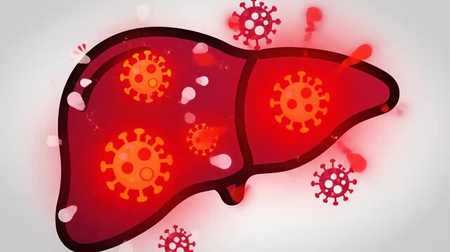 Liver Affected by Hepatitis B Virus Infection