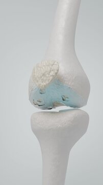 Knee Joint Injection Therapy for Osteoarthritis Pain Relief 3D rendering