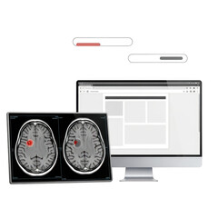 Brain scan with tumor highlighted, isolated on transparent background