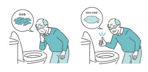 大腸カメラ前処置の便の状態比較イラスト（高齢男性・泥状便NG・透明な水様便OK）