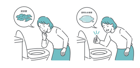 大腸カメラ前処置の便の状態比較イラスト（女性・泥状便NG・透明な水様便OK）